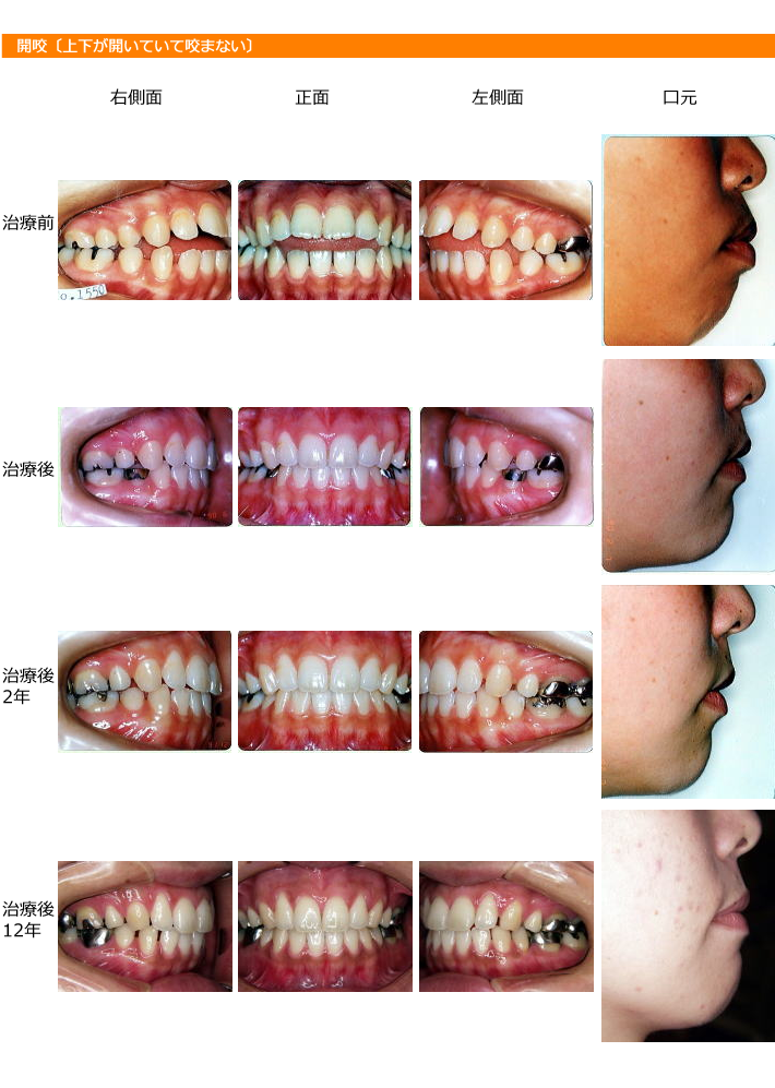img_orthodontic_dentistry12