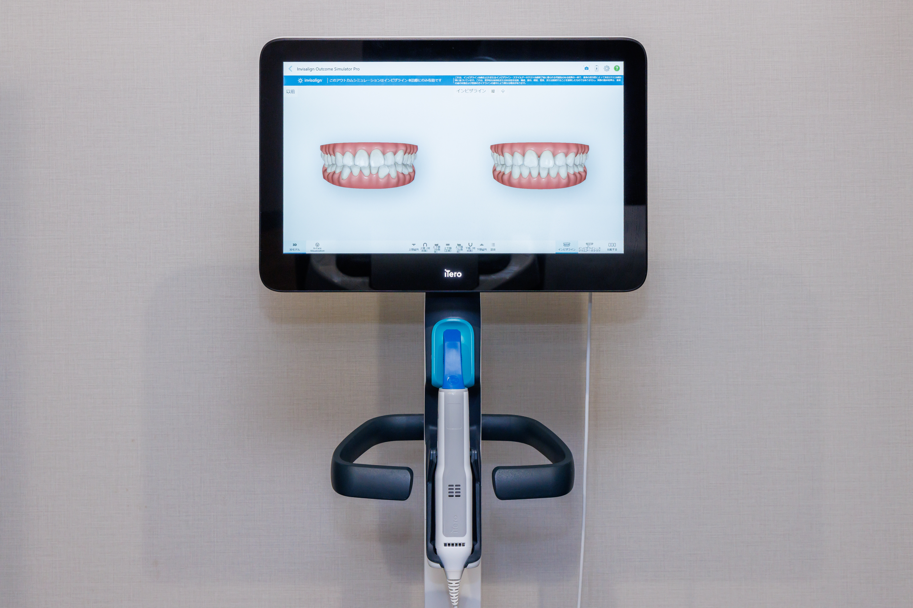 光学スキャナー