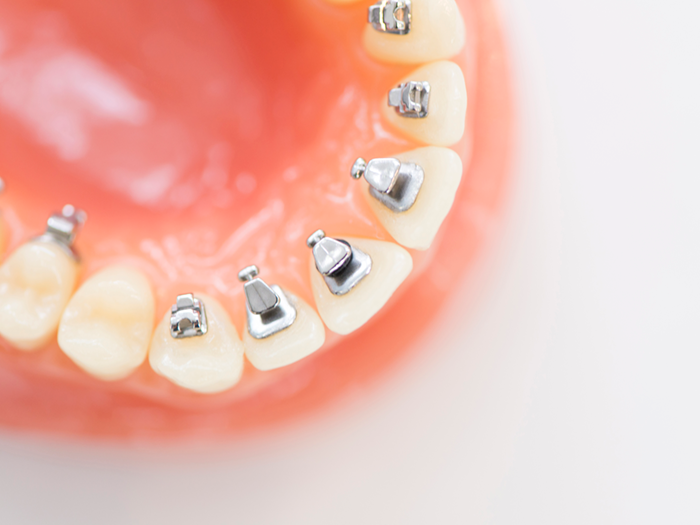 img_orthodontic_dentistry01