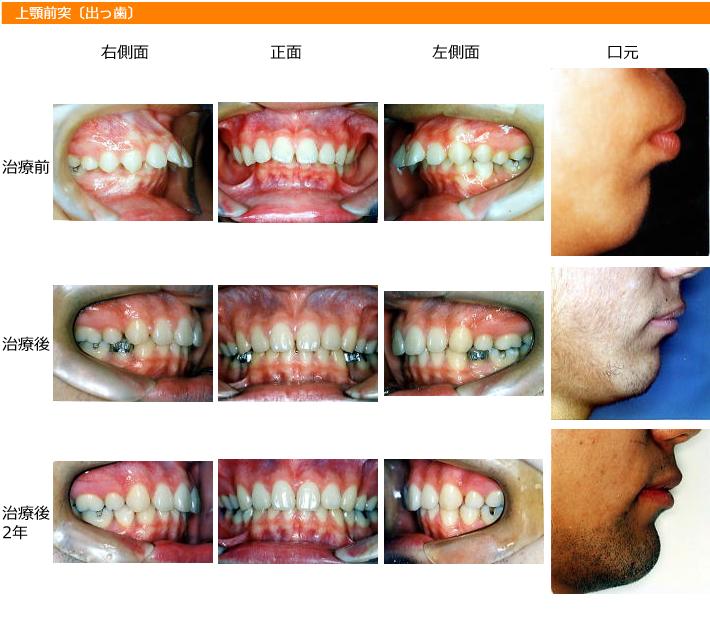 img_orthodontic_dentistry11
