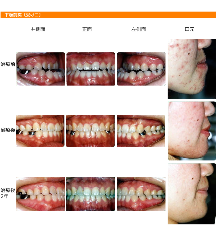 img_orthodontic_dentistry13