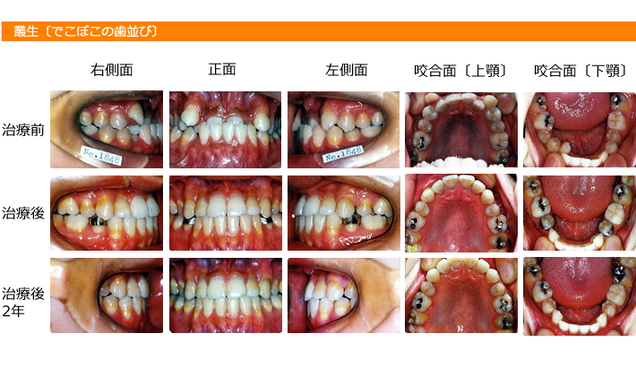 img_orthodontic_dentistry14
